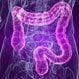 Irritable Bowel Syndrome (IBS)
