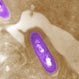 <i>Listeria</i> (Listeriosis)