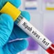 Nipah Virus Infection