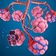 Popcorn Lung (Bronchiolitis Obliterans)