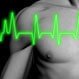 Premature Ventricular Contractions (PVCs)