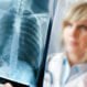 Pulmonary Fibrosis