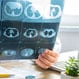 Pulmonary Hypertension