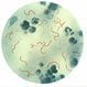 Rheumatic Fever