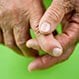 16 Early Rheumatoid Arthritis (RA) Signs & Symptoms