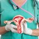 Vaginal Cancer