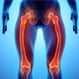 What Is Paget Disease and What Are the Symptoms?