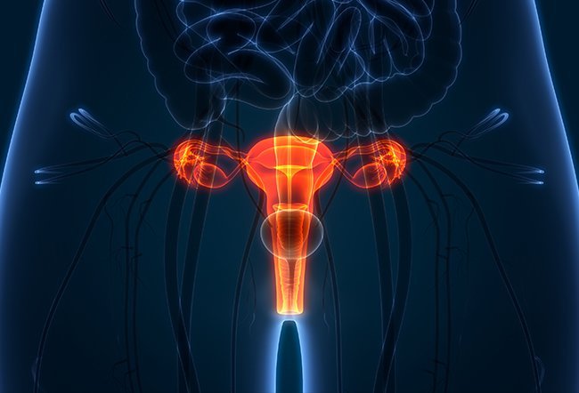Ovarian, Fallopian Tube, Primary Peritoneal Cancer Prevention