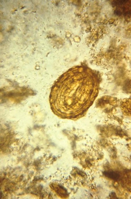 Ascaris lumbricoides