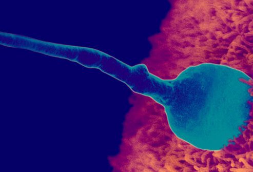 Step one of conception is when the sperm penetrates the egg to complete the genetic make-up of a human fetus.