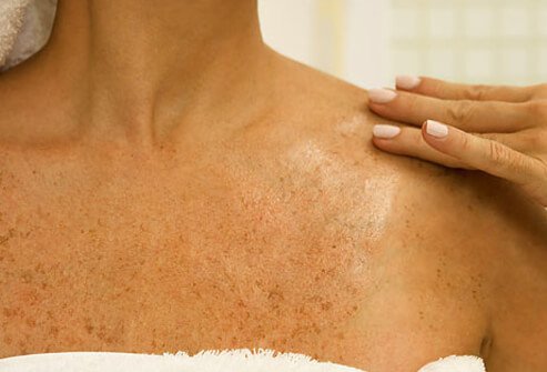 Heat therapy for fibromyalgia pain.