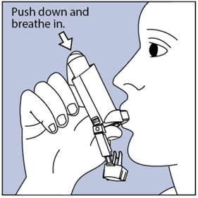 Put the mouthpiece in your mouth and close your lips around it - Illustration Put the mouthpiece in your mouth and close your lips around it - Illustration