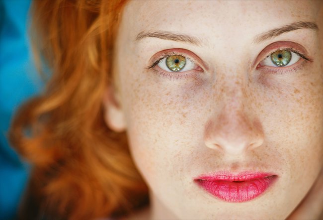are beauty marks and freckles the same thing