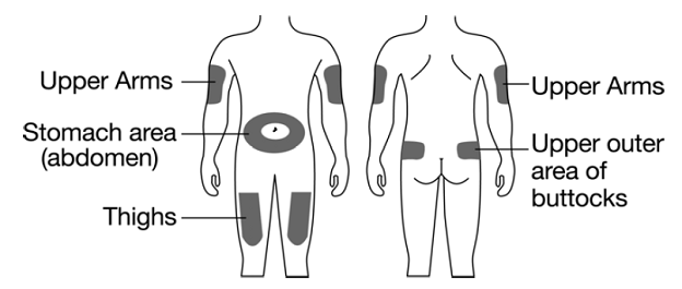 Open the tray by peeling away the cover. Grab the needle safety guard to remove the prefilled syringe from the tray - Illustration
