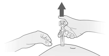 Pinch the cleaned injection site to create a firm surface - Illustration