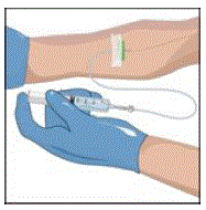 Attach the IV infusion set - Illustration