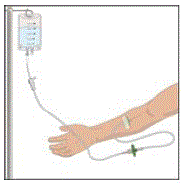 Aadminister GLASSIA solution at room temperature - Illustration