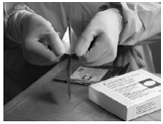 To remove the sterile inner pouch from
the outer pouch, locate the folded corner and slowly pull in an outward motion - Illustration To remove the sterile inner pouch from
the outer pouch, locate the folded corner and slowly pull in an outward motion - Illustration