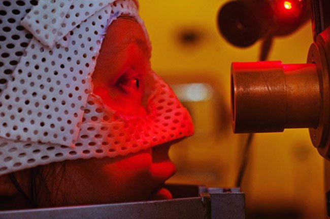 Radiation to the eye may lead to dry eyes and vision changes. 