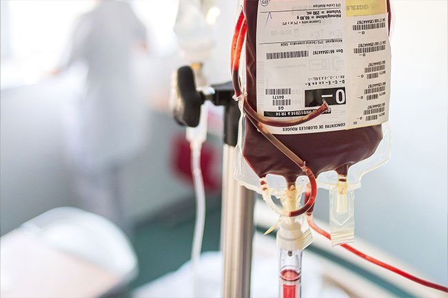 Blood transfusions are one type of sickle cell disease treatment. 