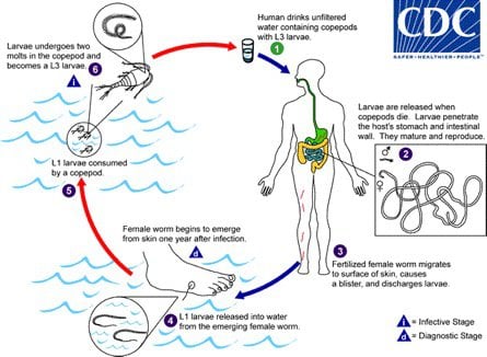 Guinea Worm Disease