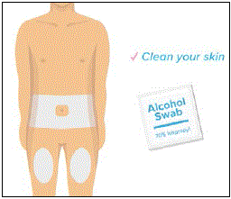 Choose an injection site on your body - Illustration