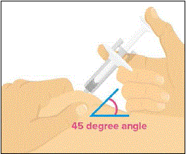 Gently pinch your skin at the injection site and insert the needle all the way into your skin at about a 45 degree angle - Illustration