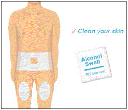 Choose an injection site on your body - Illustration