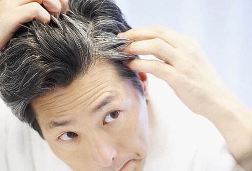 The loss of hair pigmentation is almost universal as we age.