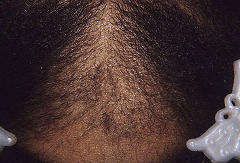 There are several ways you can damage our scalp hair to improve its cosmetic appearance.