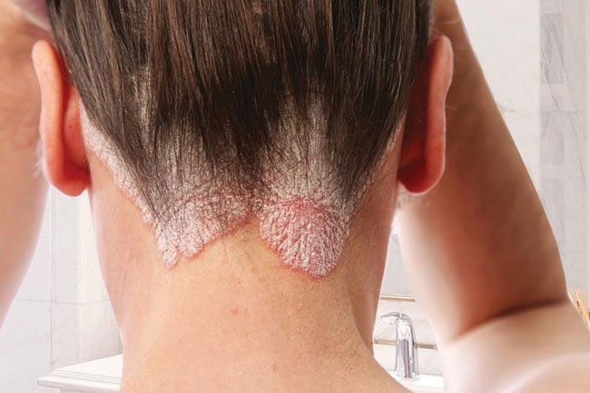 Do you have an itchy scalp?