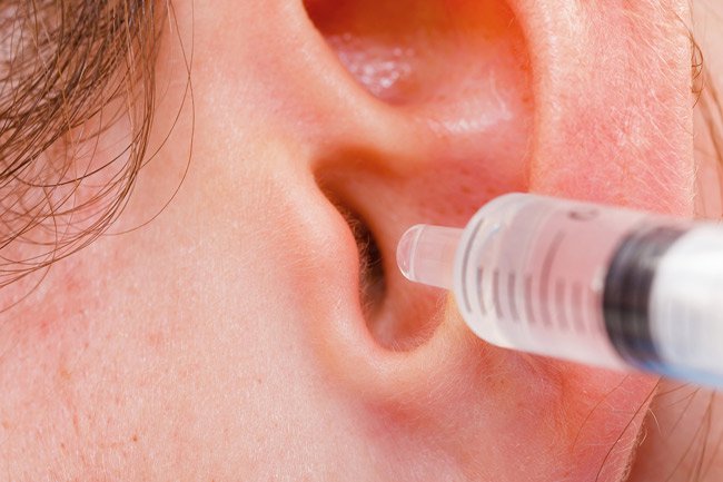 You can use a bit of hydrogen peroxide to soften earwax buildup. 