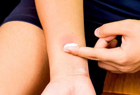 Baking soda can relieve minor irritation, pain, itching, and redness.