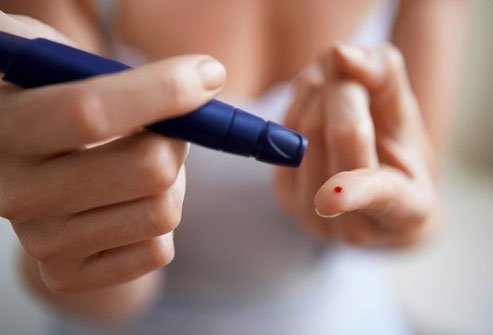 Cinnamon helps lower blood sugar. 