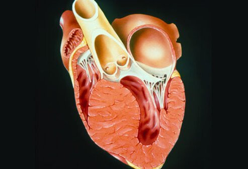 Cardiomyopathy may impair the heart’s ability to pump blood to the rest of the body.