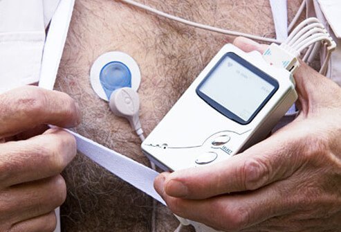 A Holter monitor is worn continuously for 1 to 2 days to capture the activity of the heart.