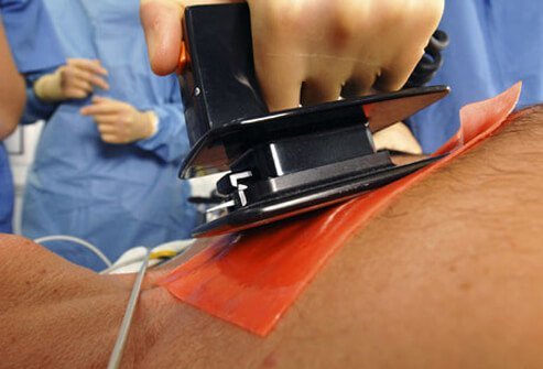 Arrhythmias may produce abnormalities in the electrical signals of the heart producing sudden death.