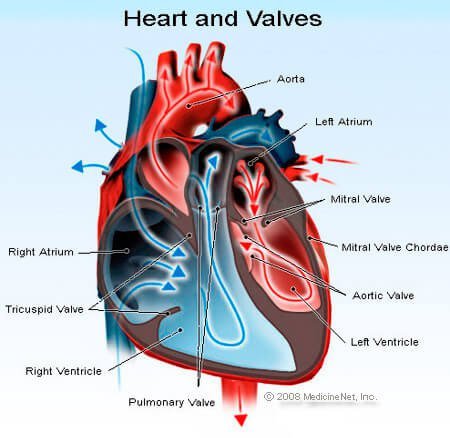 Picture of aortic valve stenosis.
