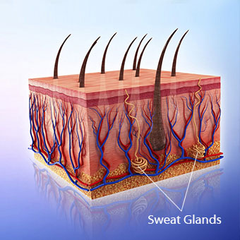 Sweat glands within the basal layers of the skin become clogged, causing heat rash.