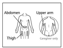 Selecting and preparing an injection site - Illustration