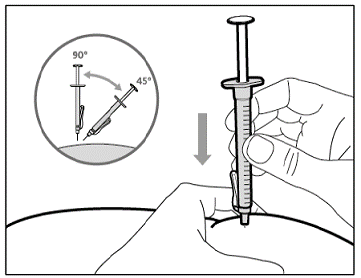Subcutaneous (under the skin) injection - Illustration
