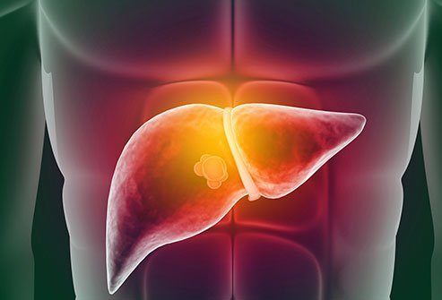 Liver hemangioma does not go away without treatment. 