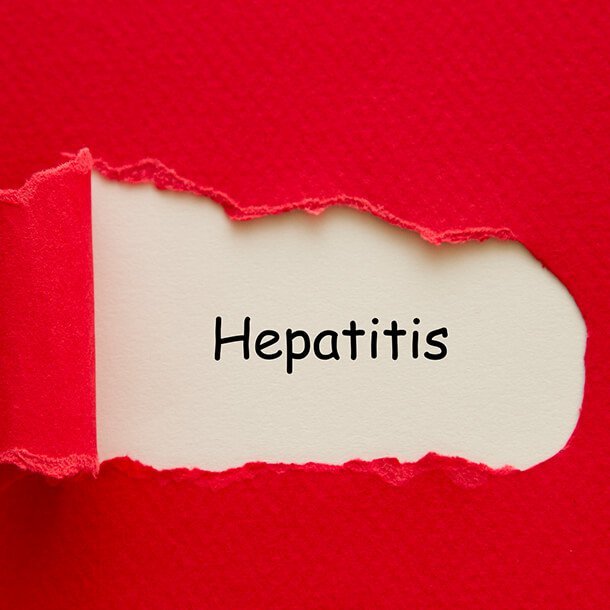Hepatitis B
