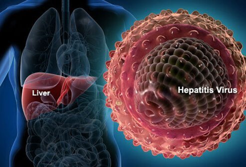 4 Common types of leukemia 