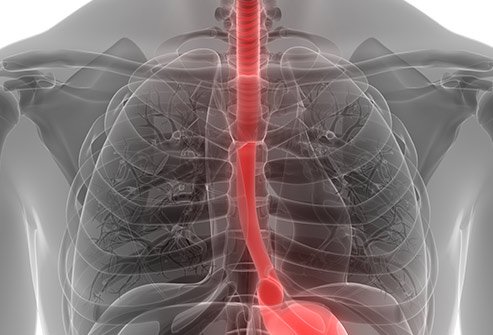 A hiatal hernia is a condition that occurs when a part of the stomach pushes through an opening in the diaphragm. Risk factors and medical conditions that can cause a hiatal hernia include being over the age of 50, obesity, heavy lifting, smoking, pregnancy, and straining (bowel movement or exercise). A hiatal hernia is a condition that occurs when a part of the stomach pushes through an opening in the diaphragm. Risk factors and medical conditions that can cause a hiatal hernia include being over the age of 50, obesity, heavy lifting, smoking, pregnancy, and straining (bowel movement or exercise).