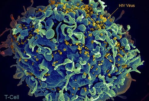 HIV attacks white blood cells of the immune system. 