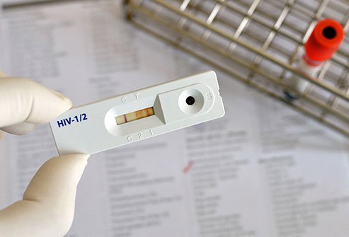 The Centers for Disease Control and Prevention (CDC) recommends all people between the ages of 13 and 64 get tested for HIV at least once as a part of routine health care.
