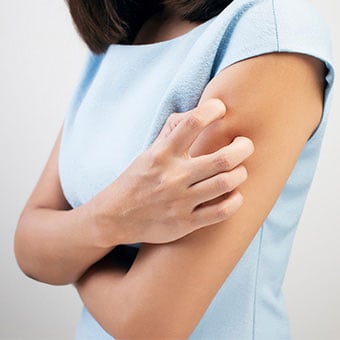A woman scratches at her itching arms.
