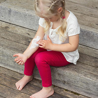 A young girl puts lotion on her arm to treat her hives.
