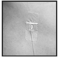 Put sterile gauze and tape or a transparent dressing over the injection site - Illustration